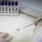 Secretaria de Saúde de SP investiga novo caso suspeito de ebola